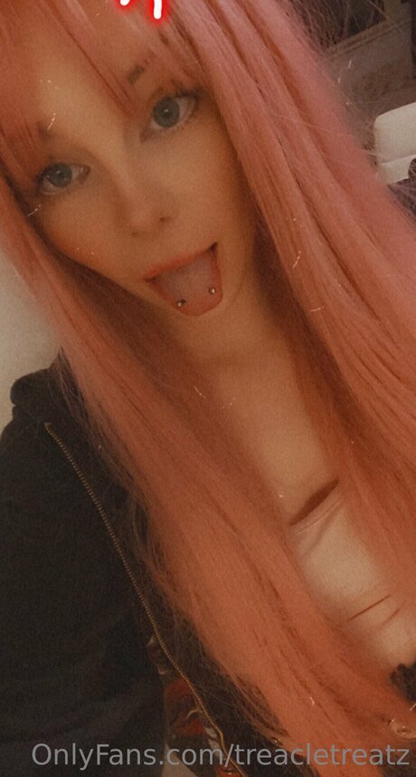 Treacletreatz