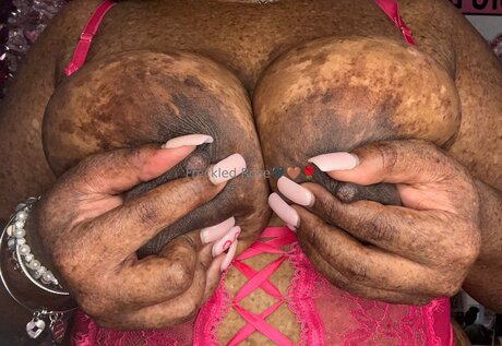 Freckledfantasy5