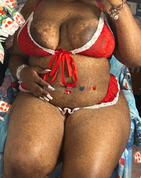 Freckledfantasy5