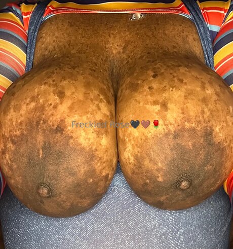 Freckledfantasy5
