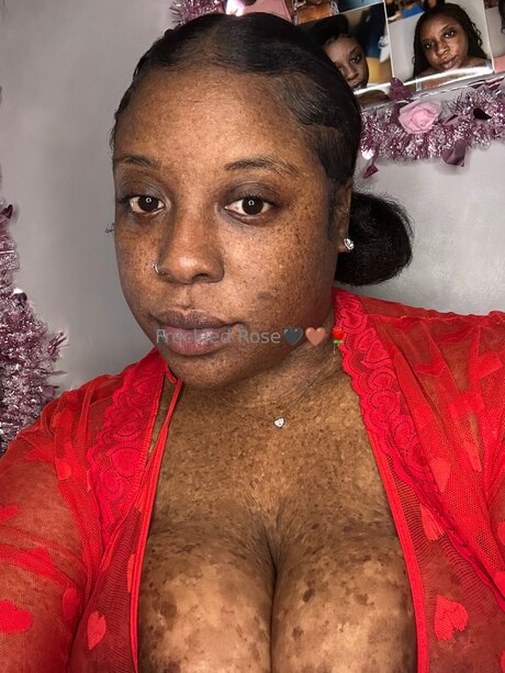 Freckledfantasy5