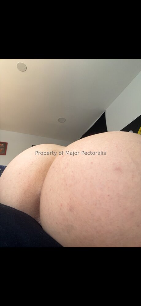 Majorpectoralis