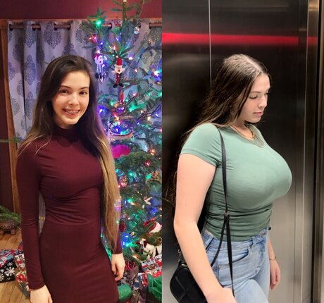 Growing Breasts
