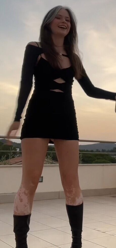 Nadinebreaty