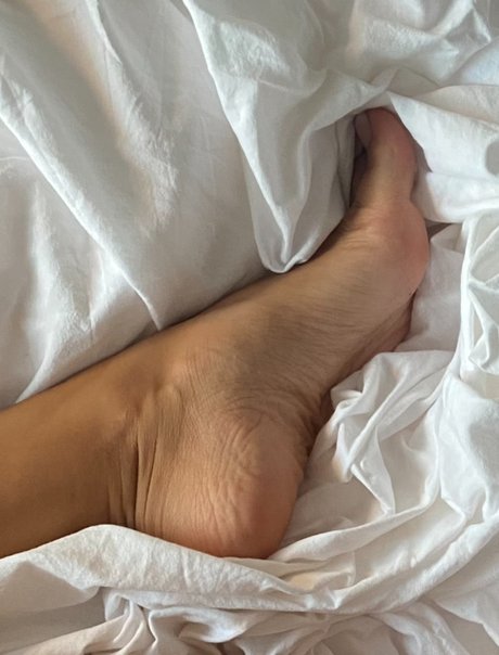 Birthmark Feet