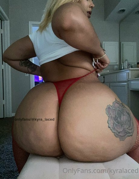 Kyralaced