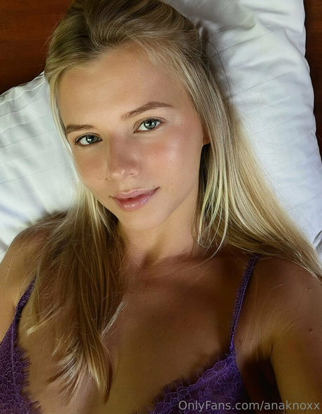 Anaknoxx
