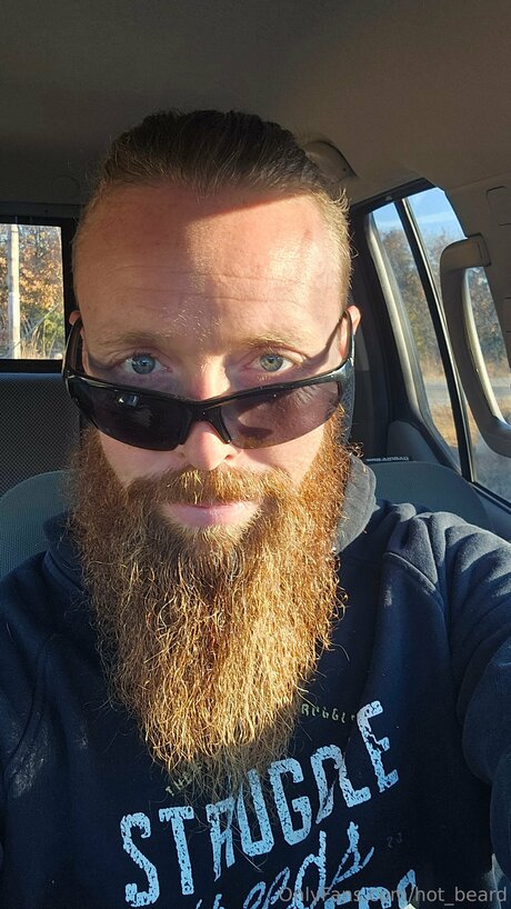 Hot Beard