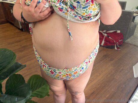 Celluliteangel
