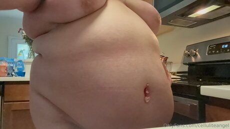 Celluliteangel