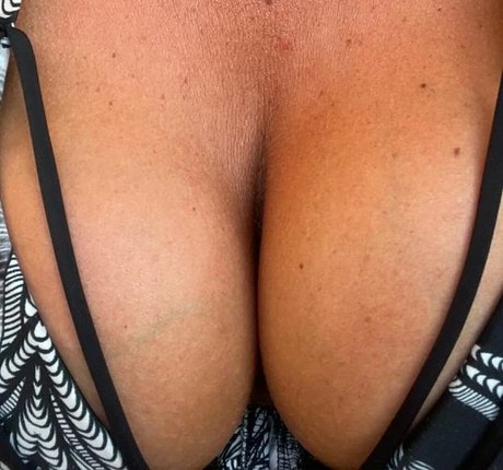 Nipsstrips