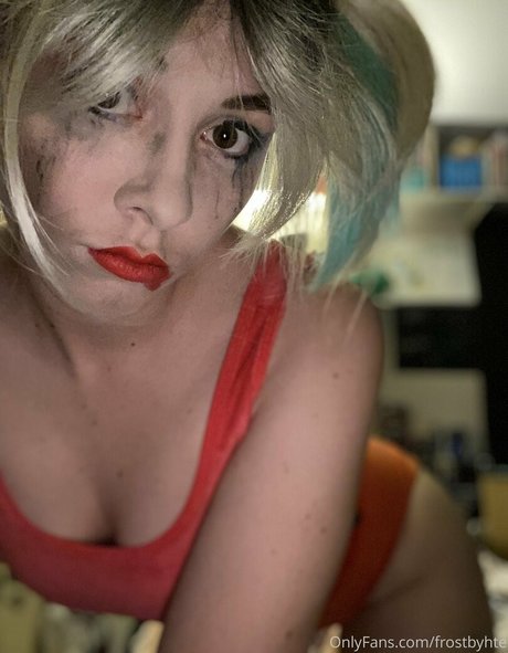 Frostbyhte