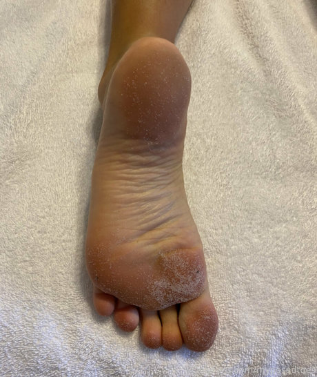 Myposedtoes