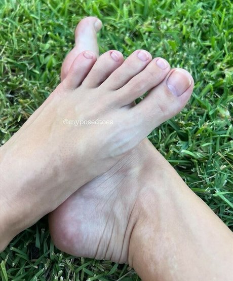 Myposedtoes
