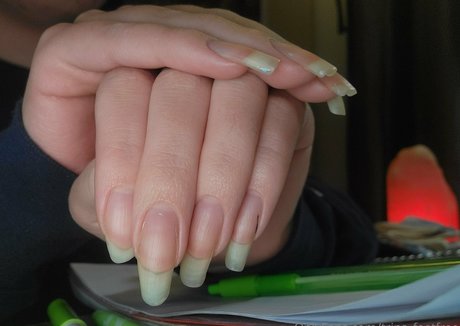 Trinsfeetfree